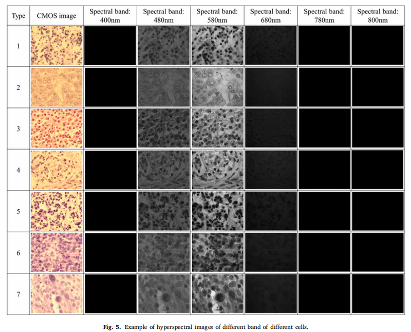 Hyperspectral Pathology Image.png