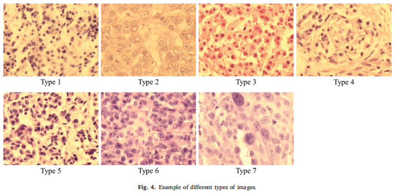 Hyperspectral Pathology Image 4.png